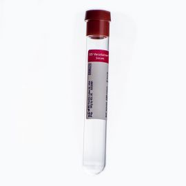 RED TOP VACUTAINER TUBE 10ML