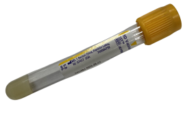 GOLD VACUTAINER TUBE - 5 ML